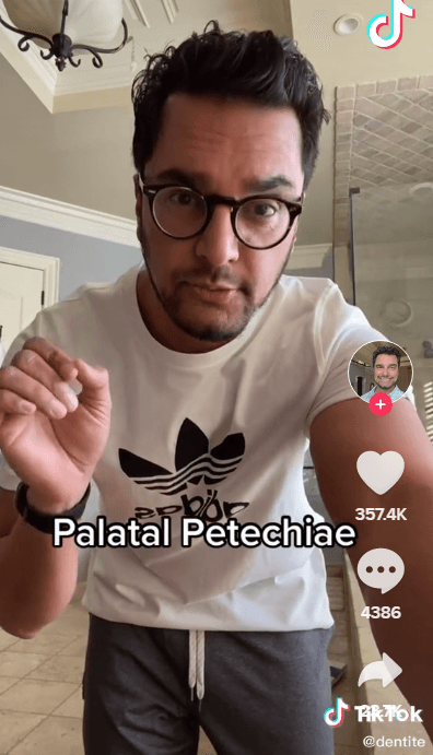 網紅牙醫在抖音解釋何謂顎部瘀斑。（翻攝TikTok@dentite）