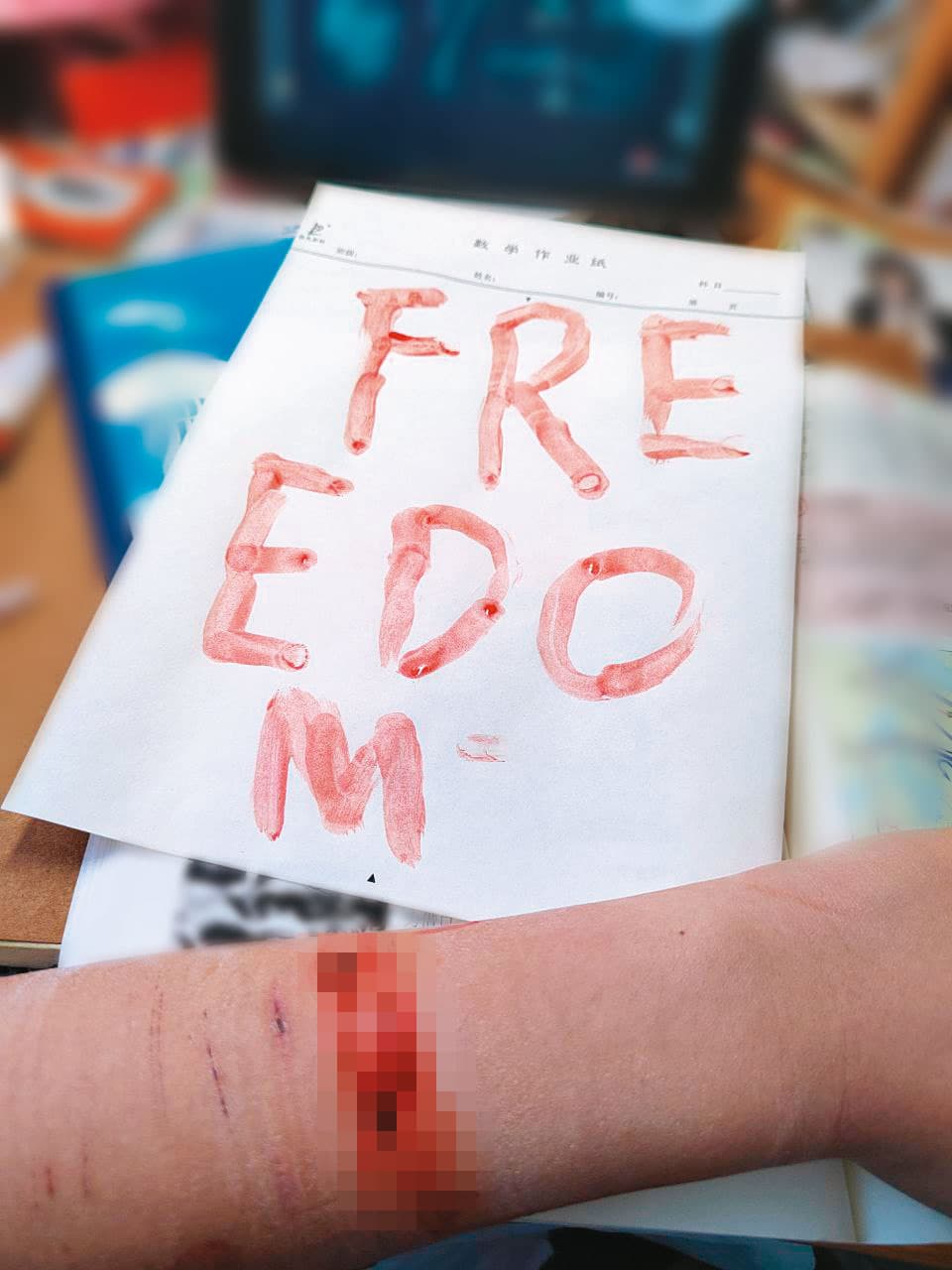 微信上有中國網友以血書響應白紙運動,自殘寫下Freedom。(受訪者提供)