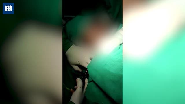 醫師花了一個半小時手術,成功將三叉戟取出。(翻自《每日郵報》)