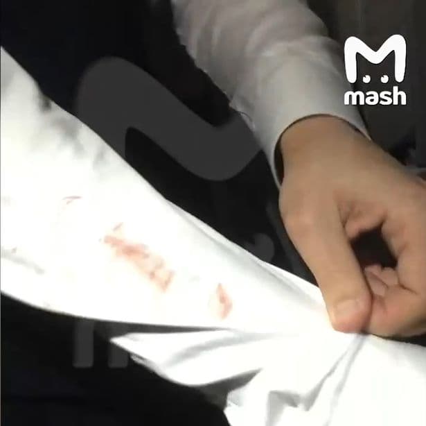 一名男性空服員被摩絲維提娜亂咬濺血。(翻自《每日郵報》)