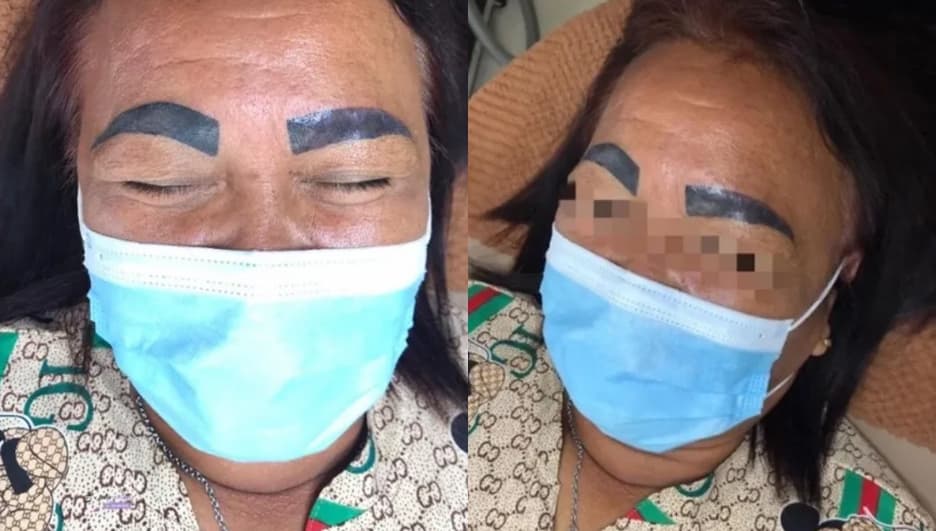 婦人對紋眉結果非常不滿，只能求助其他紋眉師父挽救。（翻攝臉書6D Eyebrow Tattoo Phetchabun By Ajarn Pangpond）