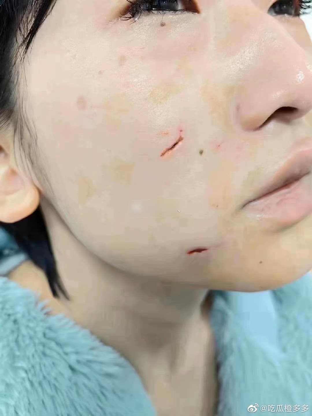 妹子事後上傳破相照。(翻自微博)