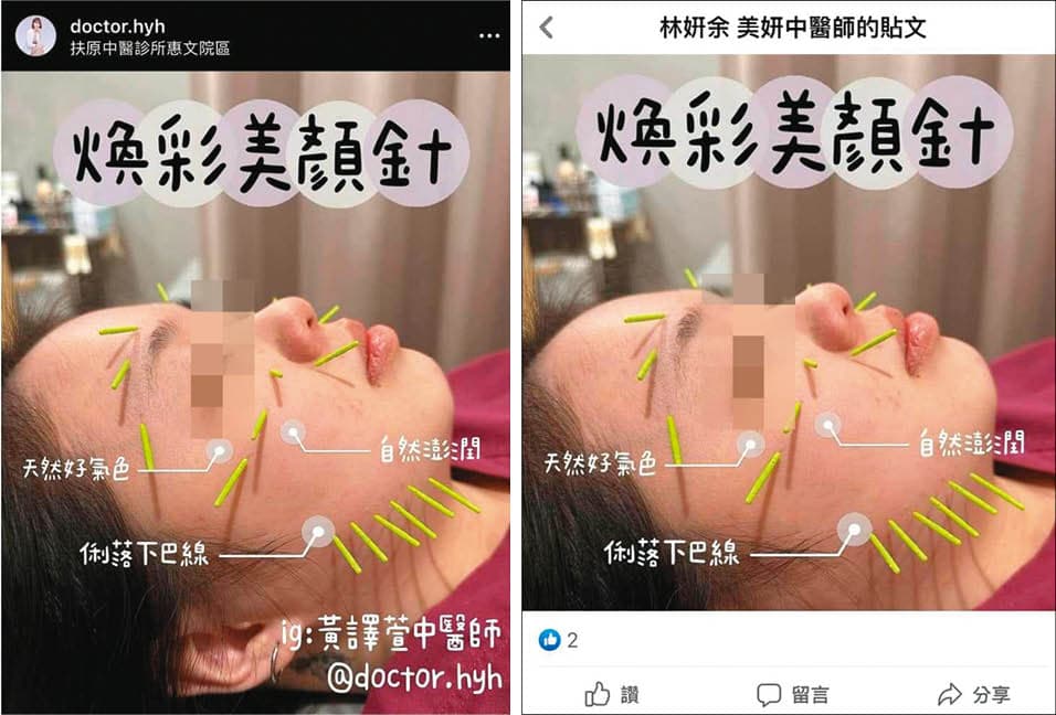 中醫師黃譯萱（左）指控林妍余多次盜用她的圖文（如右），侵害肖像權及著作權。（翻攝黃譯萱中醫師臉書）