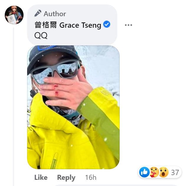 曾格爾貼出受傷照,喊QQ。(翻攝曾格爾臉書)