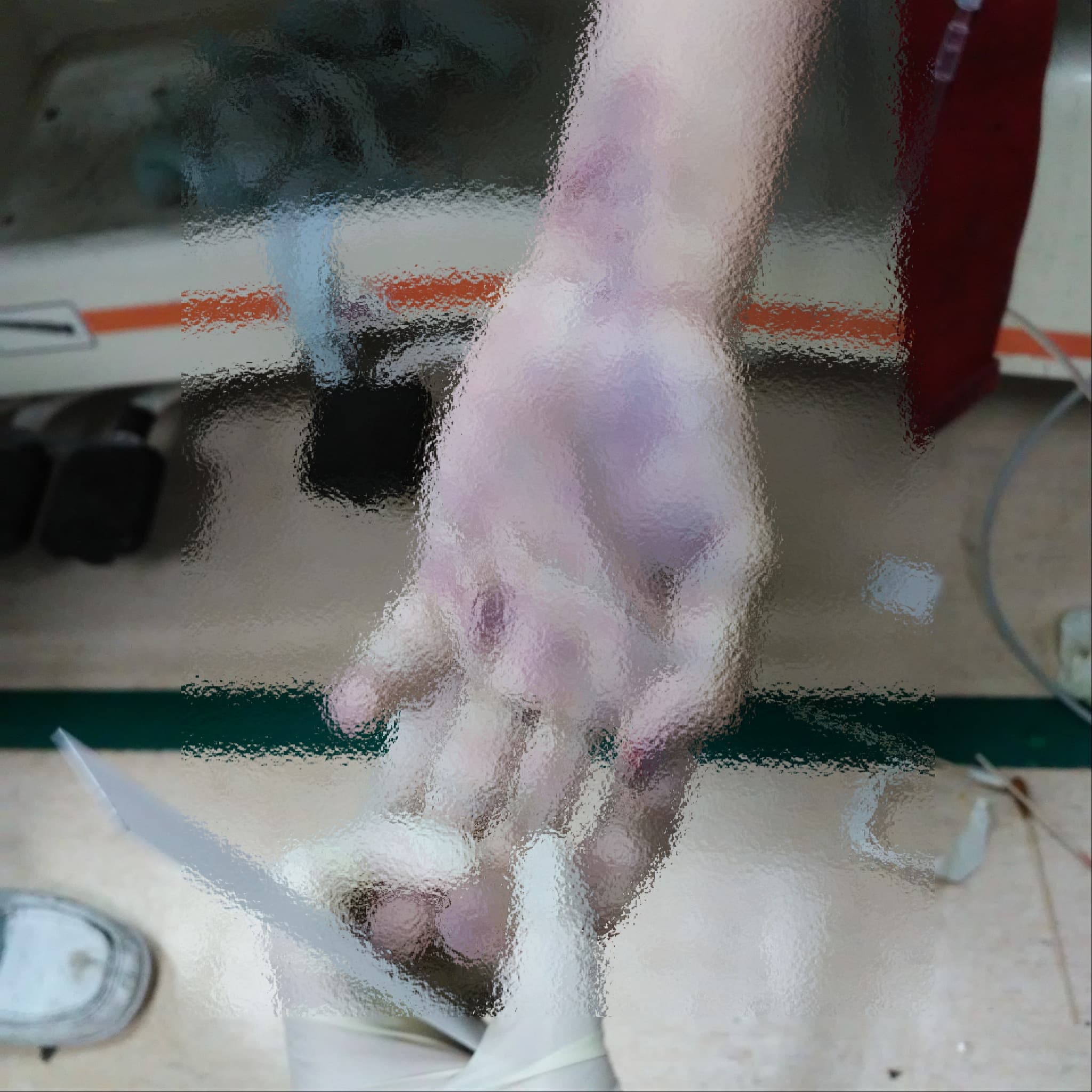 賴生左手拇指指甲處有疑似血漬。(家屬提供)