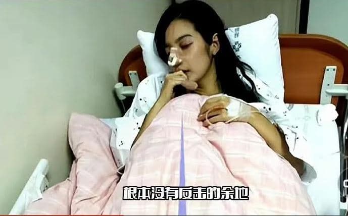 陸網Po照指林志玲被打斷鼻子,但照片中女子是韓星李敏英。(網路圖片)