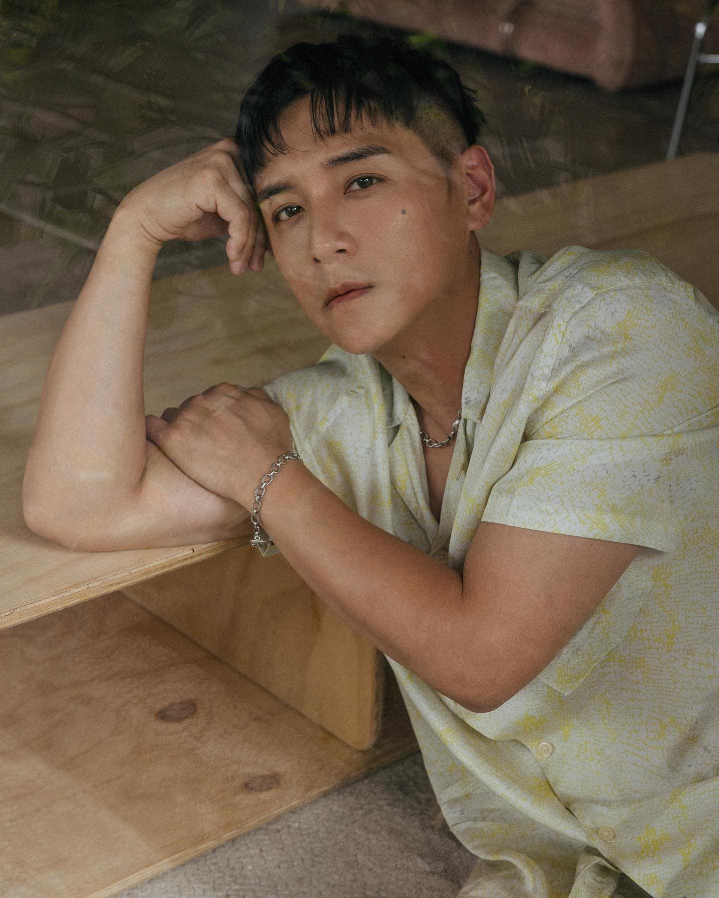戲約不斷的鄭人碩因右臉受傷，為了不耽誤即將殺青的新戲，他避開右臉以左臉入鏡，技術性完成拍攝。（翻攝自鄭人碩臉書）