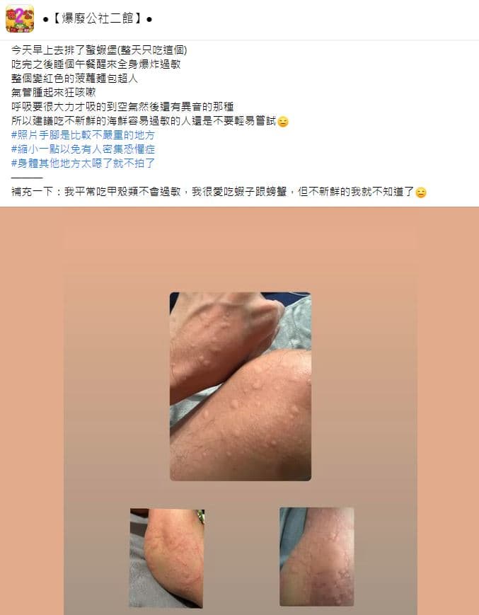 有民眾稱吃了螯龍蝦堡後嚴重過敏。(翻攝自●【爆廢公社二館】●臉書)
