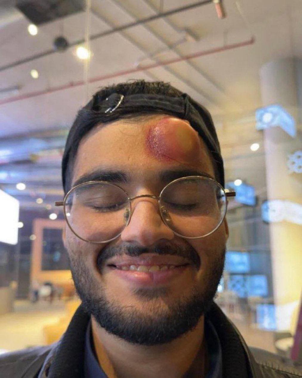 網路瘋傳照片中男子為遭C羅強球擊中的攝影師,不過消息已經遭到澄清。(翻攝自Football Hub推特)