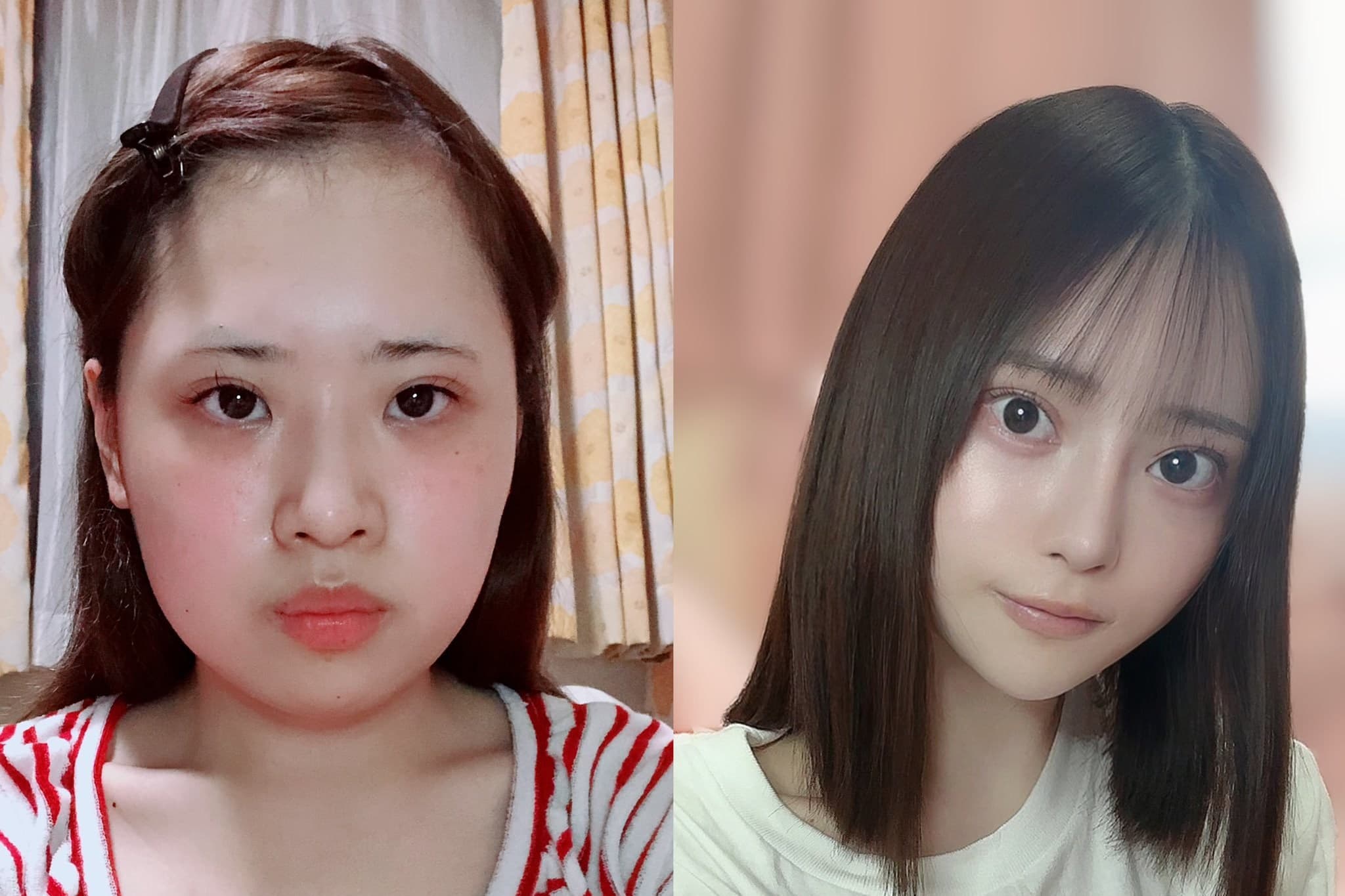 日本一名女子花費至少800萬日圓整形,成功變身成為一名正妹,手術前後照片引起網友熱議。(翻攝自@karinntter推特)
