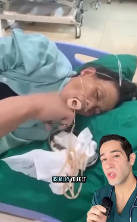 一名女病患照胃鏡時被發現有寄生蟲,醫護人員拿工具幫她拉出寄生蟲。(翻攝IG@doctormyro)