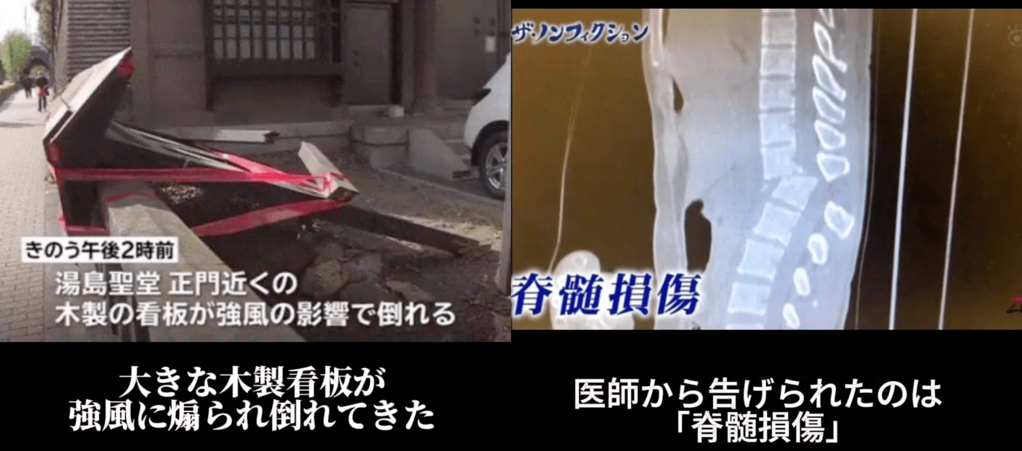 日女星豬狩友香在2018年被大風吹落的大型看板砸中。(翻攝豬狩友香INS)