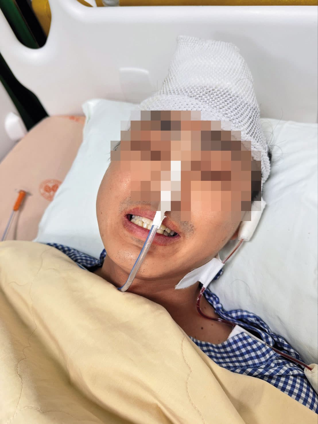 杜男術後住進加護病房,情況一度不穩,還有認知錯亂等後遺症。(讀者提供)