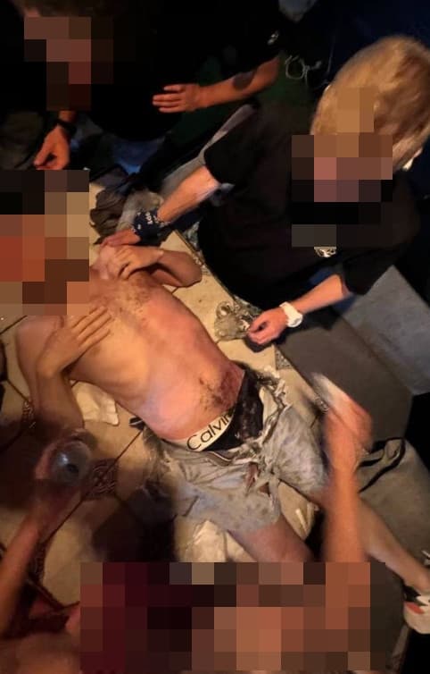 俄男遭雷擊後，身上衣物被燒得焦黑。（翻攝X@Acuteremod）