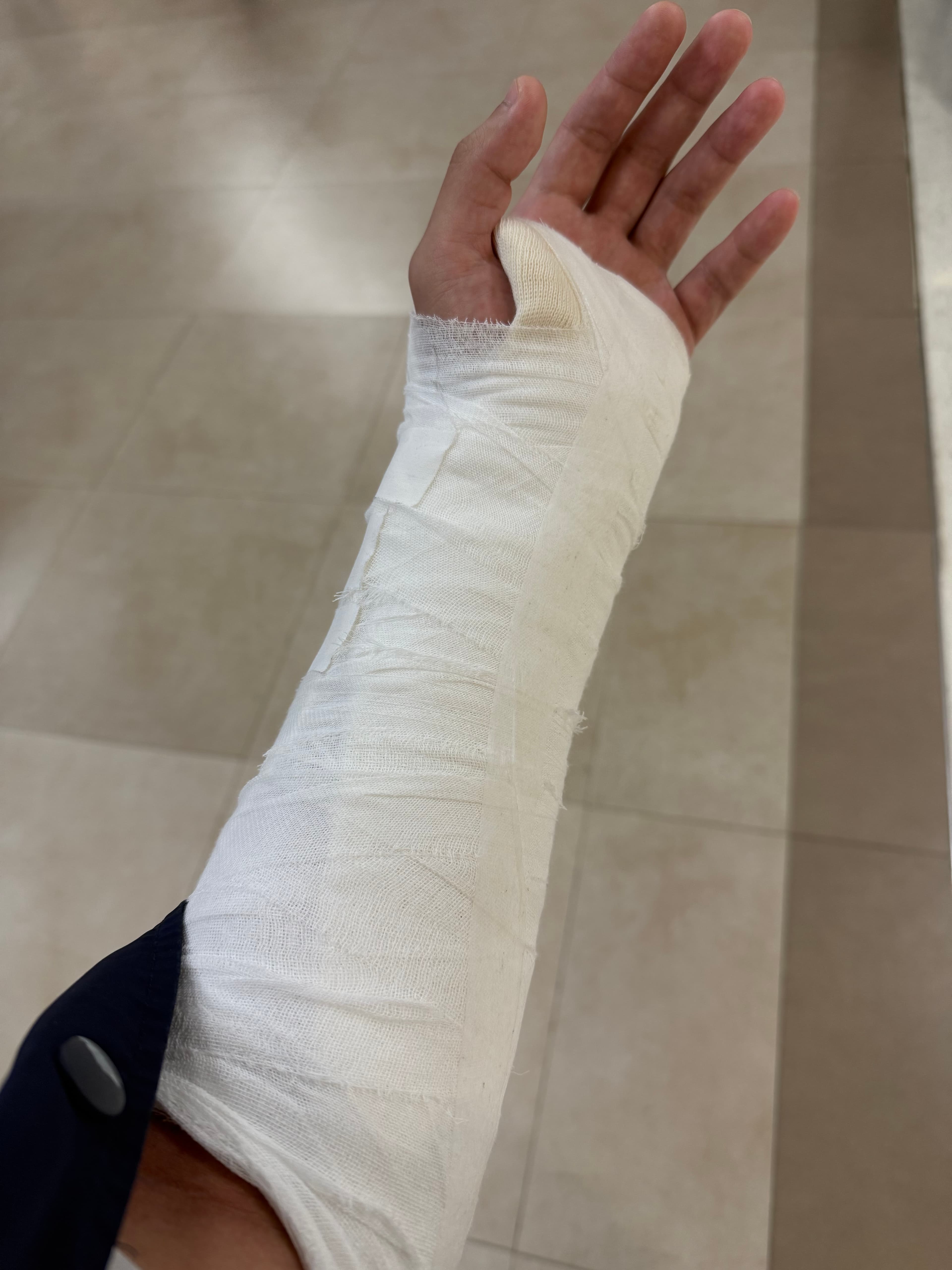 陳姓護理師的左手腕韌帶經開刀後仍需休養,目前處於公傷假期間。(讀者提供)