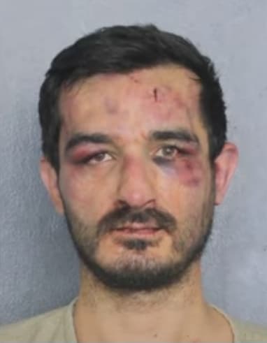 闖入民宅的醉漢被MMA拳手修理到鼻青臉腫，最後拍下狼狽囚犯照。（翻攝自youtube@CBS 12 News - WPEC）