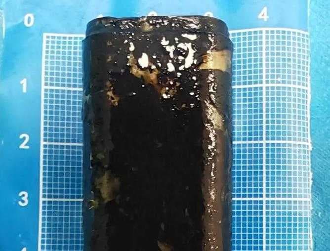 醫療團隊以微創方式成功取出男子胃中滯留30年的打火機。而被胃酸腐蝕變黑的打火機仍保有結構,甚至還能正常使用。(翻攝自微博/四川觀察)