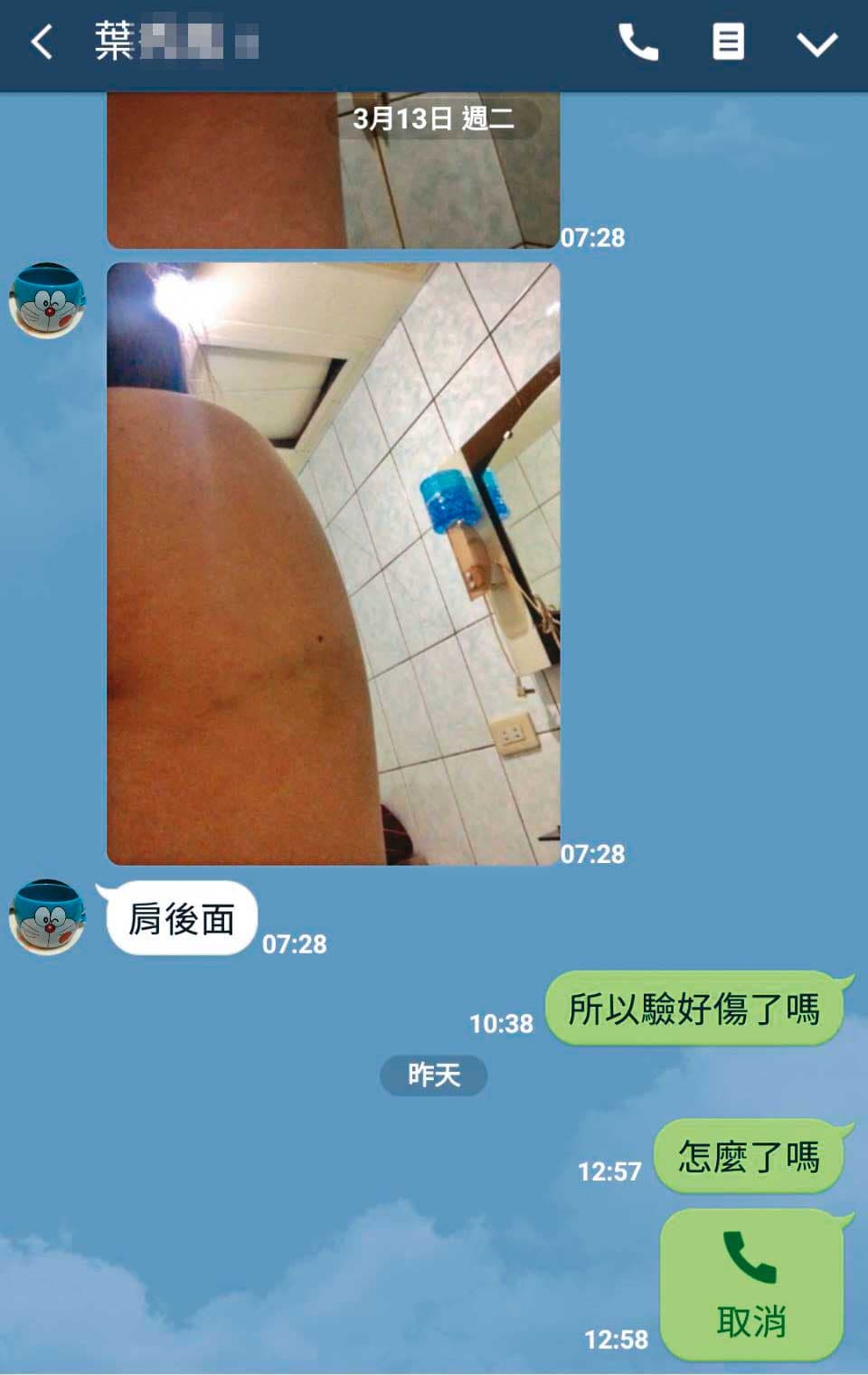 死者肩膀曾被大嫂打傷,她因此準備驗傷提告。(翻攝畫面)