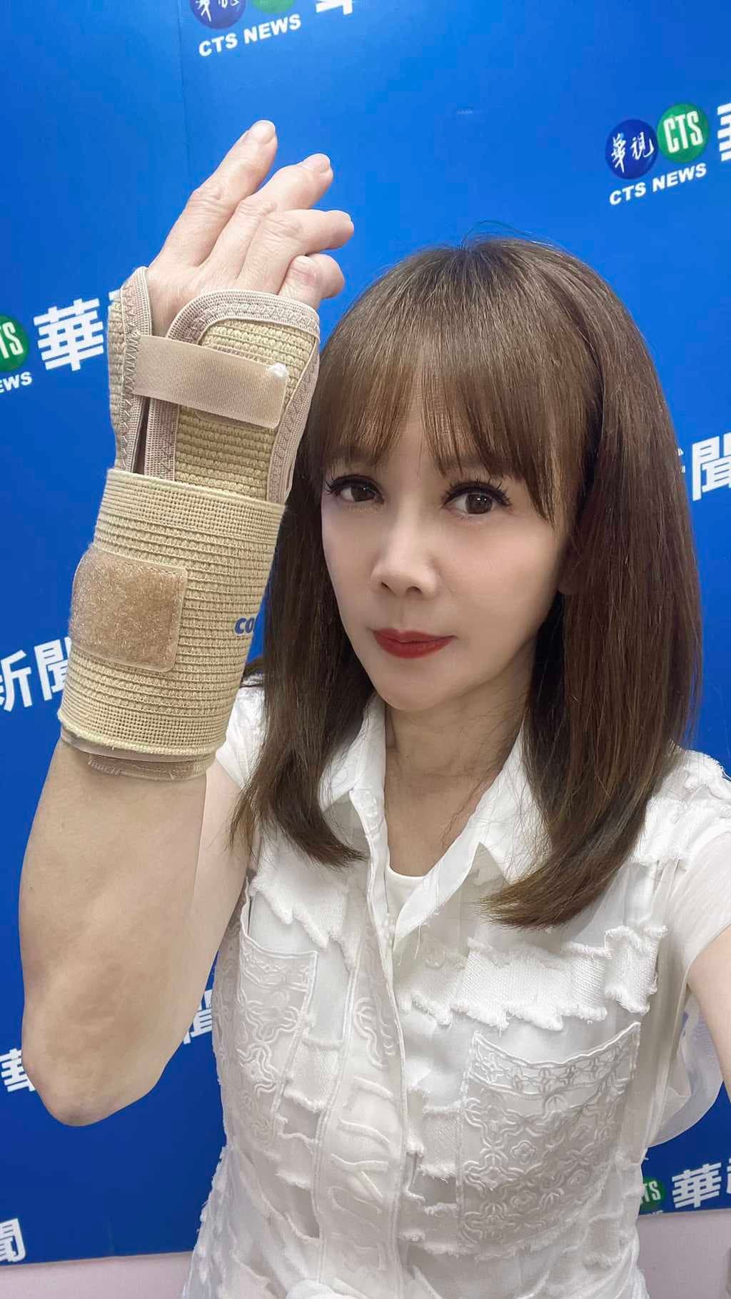 陳雅琳右手骨折,需要3個月時間復原。(翻攝自陳雅琳臉書)