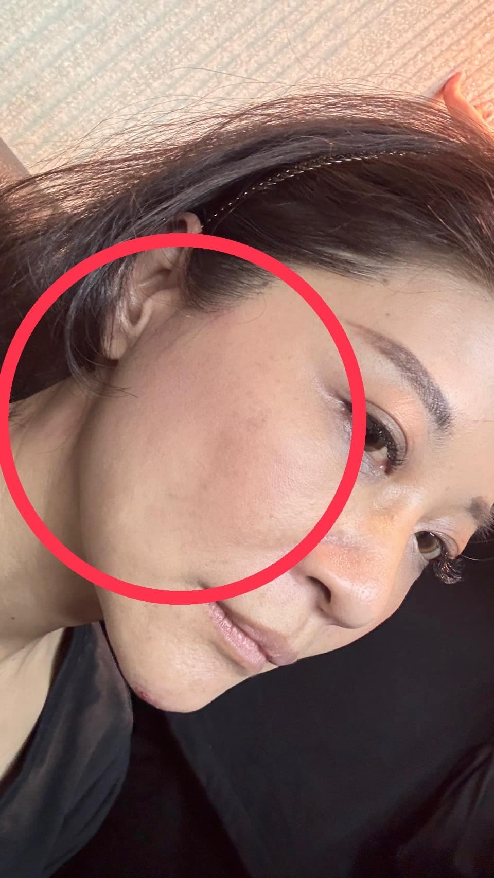 林楚茵被王鴻薇連續打好幾個巴掌。(翻攝自立法委員 林楚茵臉書)