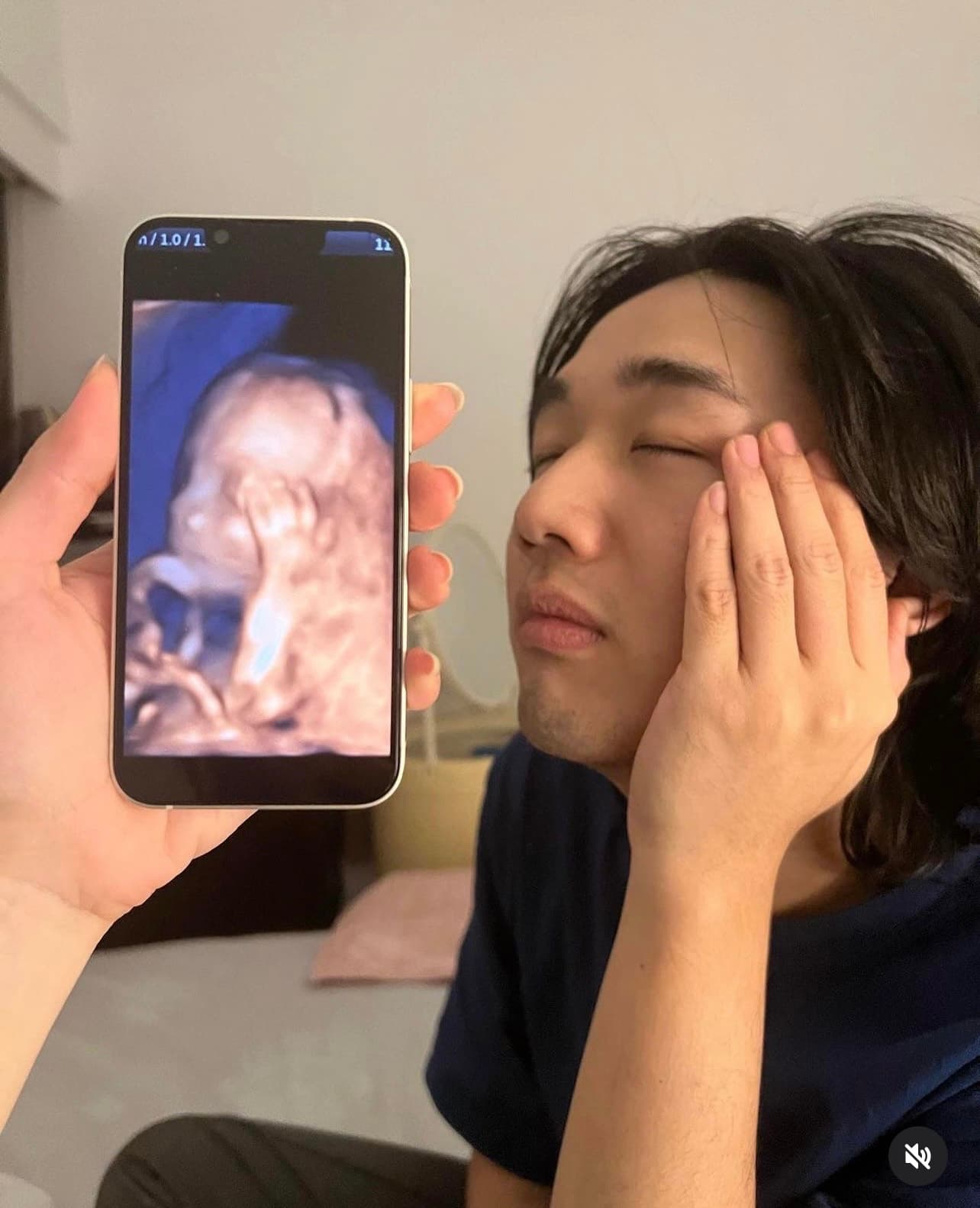 李權哲和寶寶的超音波對比照,相當逗趣。(翻攝自李權哲IG)