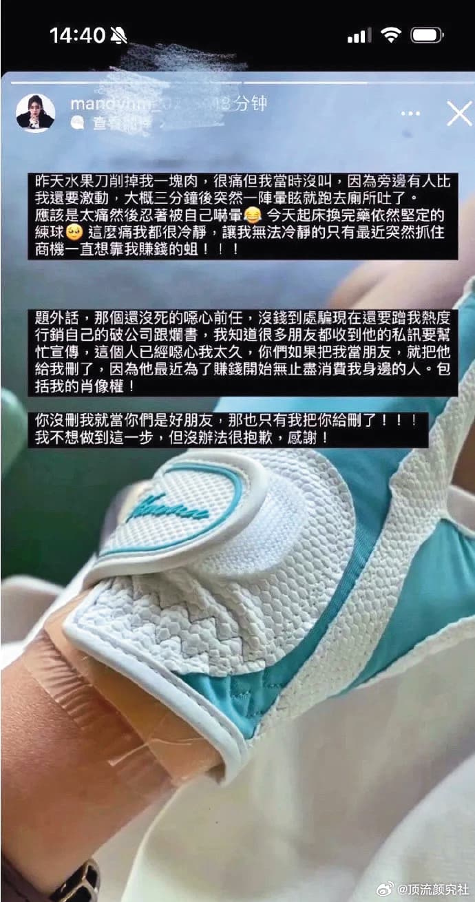 日前汪小菲未婚妻Mandy在網路上發文,除曬出受傷的手部照片,也開罵前任消費她。(翻攝自微博)