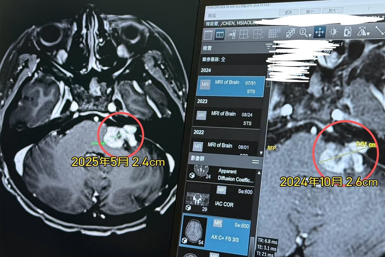 陳筱蕾抗癌至今達6年多，終於迎來腫瘤縮小0.2公分的好消息。（翻攝自臉書@陳筱蕾）