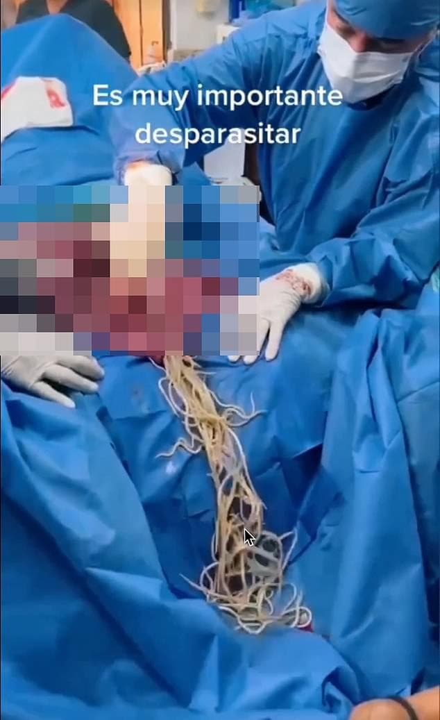 加利表示,這雖然是馬兒的手術,但人類也有可能感染這種蛔蟲。(翻自《每日郵報》)