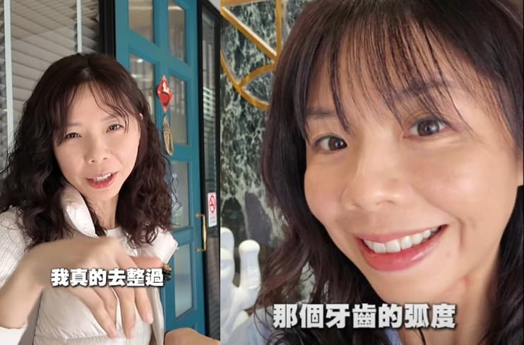 洪慈庸針對整形傳聞大方坦言有去整牙，目前對自己笑容更有自信。（翻攝臉書@洪慈庸）