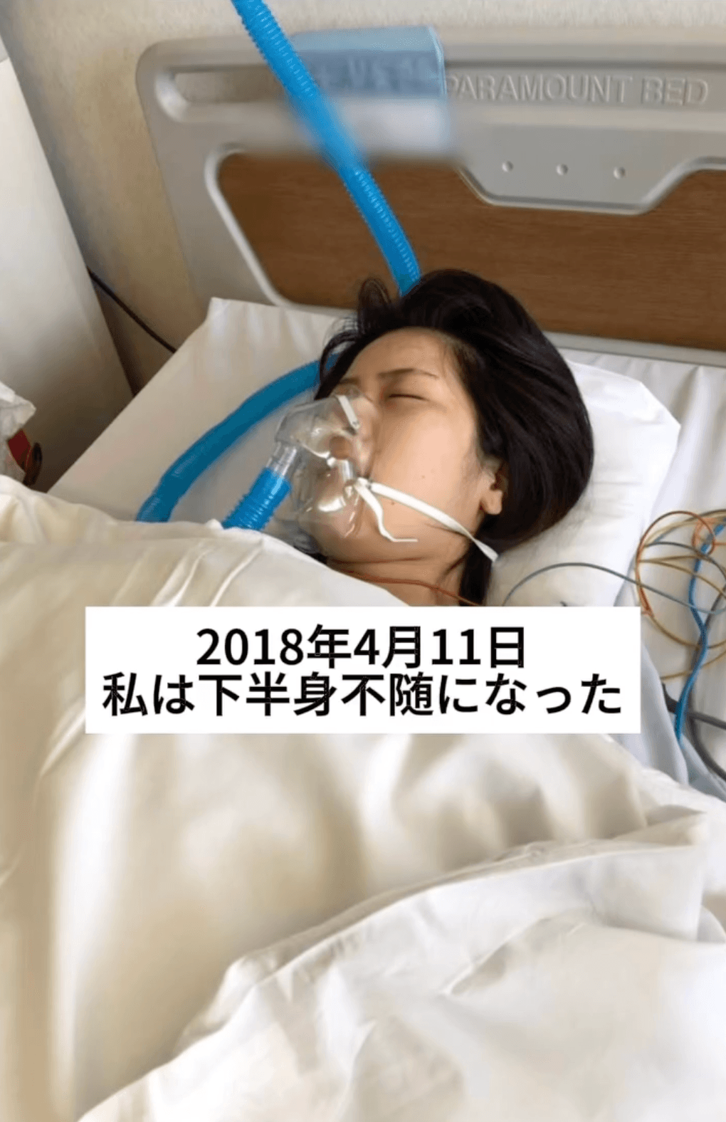 日女星豬狩友香從2018年4月11日被宣布下半身不遂,甚至無法自主排泄。(翻攝豬狩友香INS)