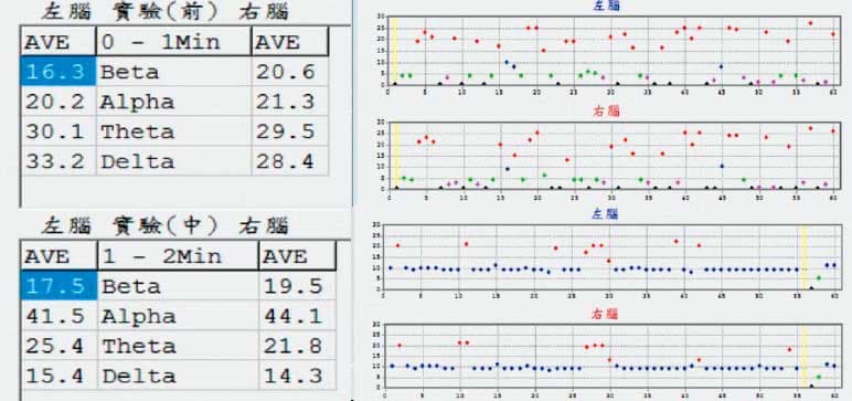 經10分鐘「調整」,業者秀出圖表告訴記者,「焦慮腦」的問題有明顯改善。