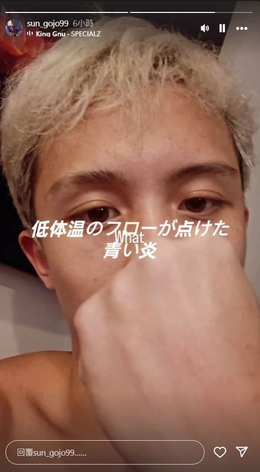被毆打後,孫安佐限動雲淡風輕。(翻攝自孫安佐IG)