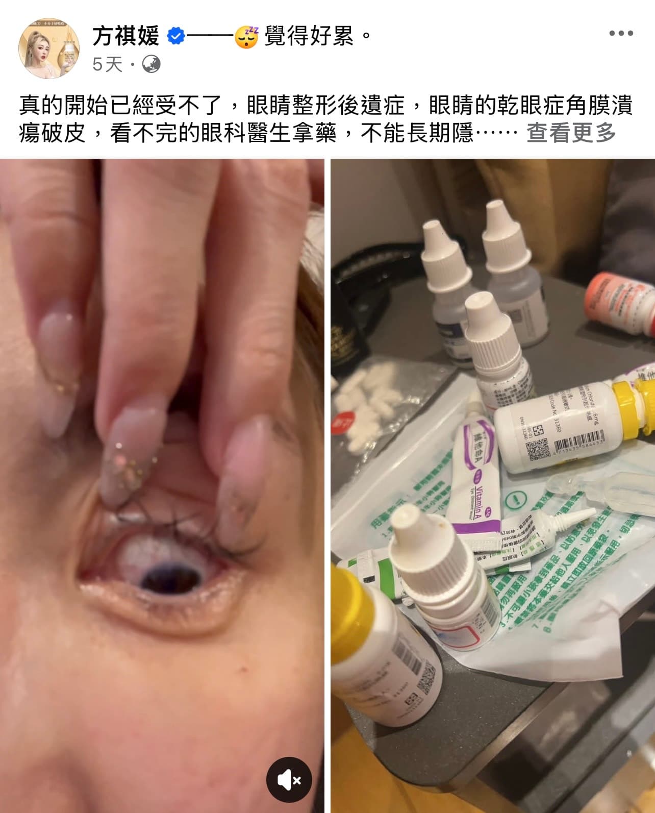 雪碧因「提眼肌太高」,頻頻掛號看眼科。(圖/翻攝自方祺媛雪碧臉書)