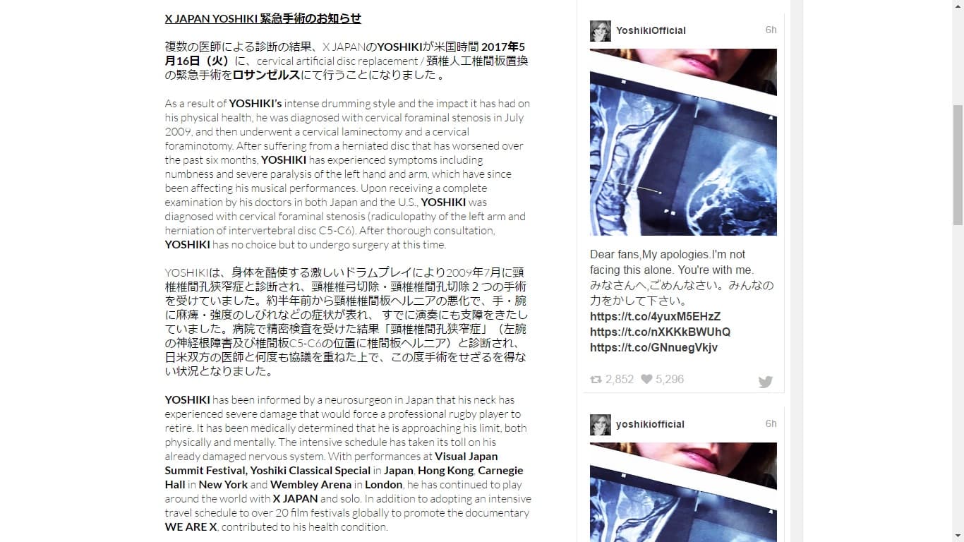 YOSHIKI在網路上發表聲明,並詳細記載美國、日本醫師對他的狀態評估。(翻攝網路)