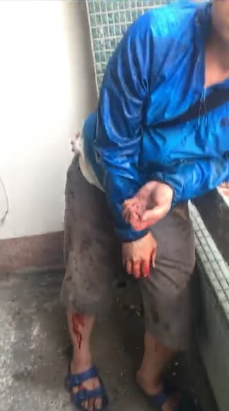 施姓男子自稱為了躲債,全身是血攀上民宅遮雨棚。(翻攝畫面)