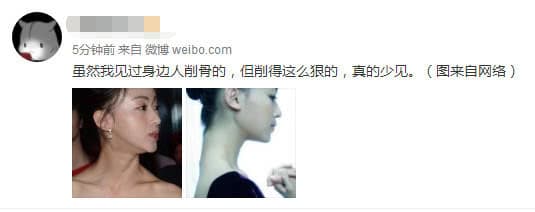 網曝吳謹言削骨,下手狠到粉絲認不出,遭調侃其臉上掛不住肉。