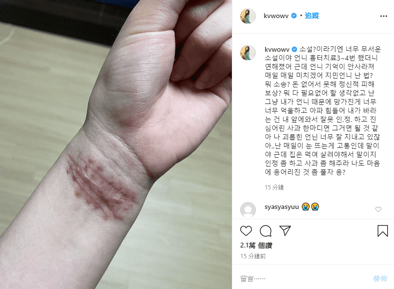 珉娥看到智珉疑嗆聲她捏造故事,PO出手腕傷痕照表示希望她可以道歉。(翻攝自珉娥IG)