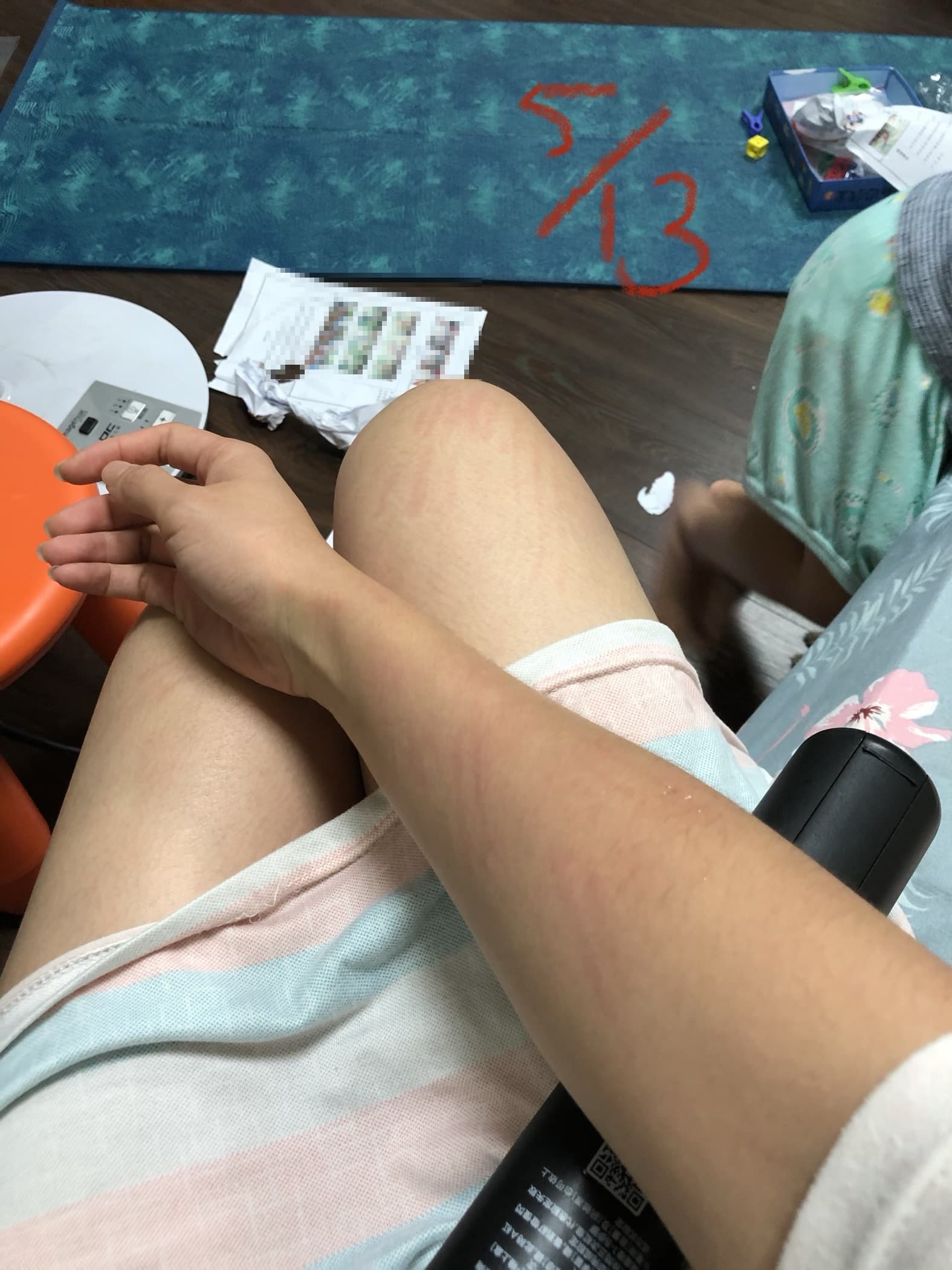 兒子失控抓咬A小姐,還說老師在學校都是這樣對待他。(讀者提供)