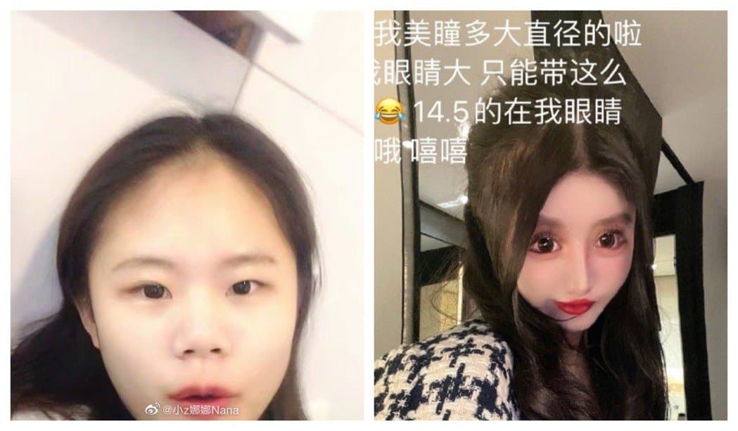周楚娜在短短3年內,就動刀超過百次。(翻攝自微博)