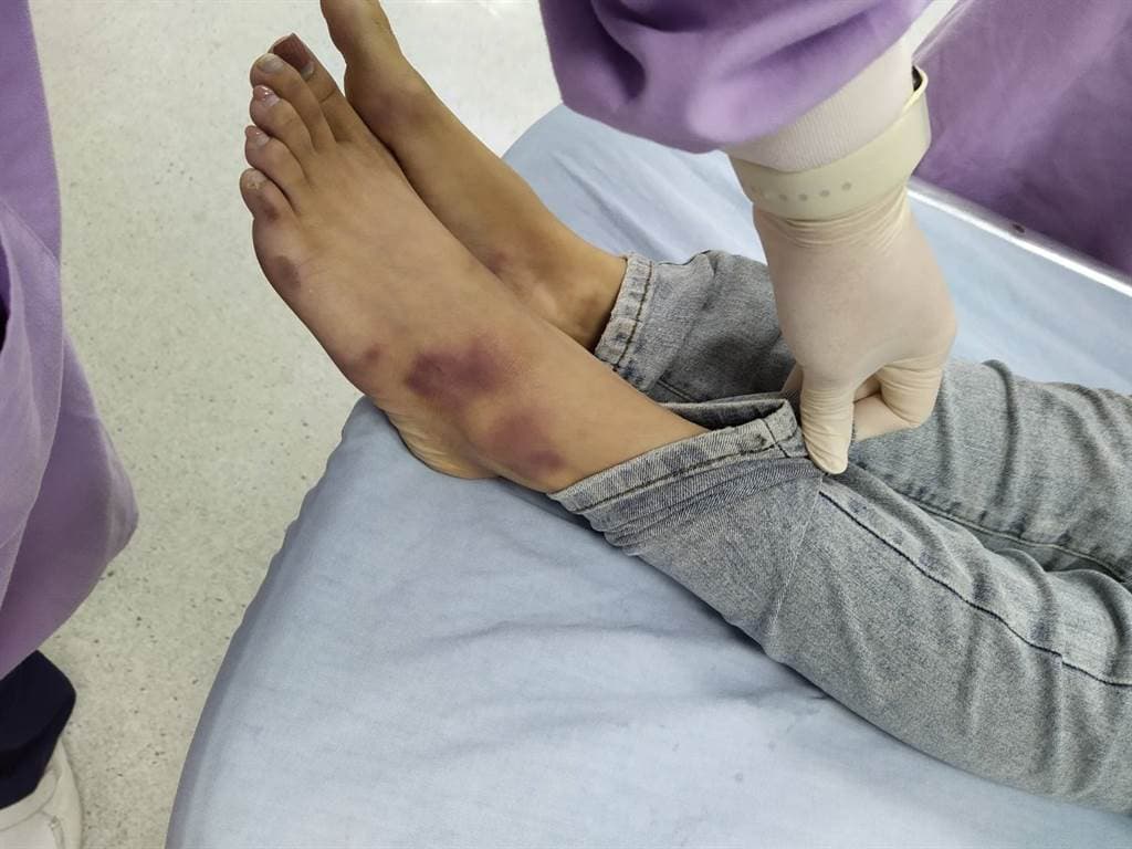 與陳修將一同入住摩鐵多日的22歲胡姓女子全身多處傷痕累累,送到彰化醫院前即已沒有生命跡象,搶救後仍宣告不治。(翻攝畫面)