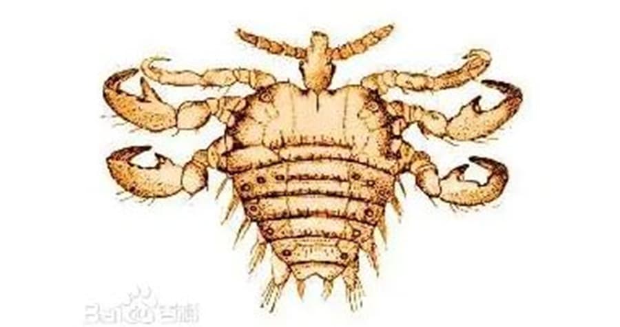 陰蝨身體扁平,遠看如同皮屑,細看則如同小螃蟹。(示意圖,翻攝自baidu.hk)