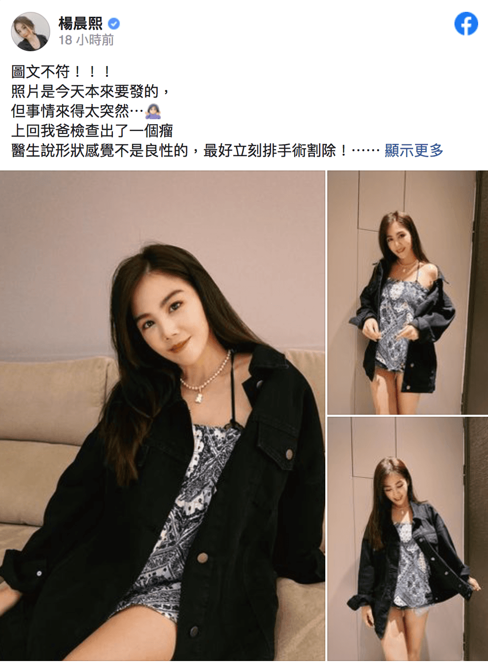 父親突接獲開刀通知,楊晨熙接到通知立即奔赴醫院。(翻攝自楊晨熙臉書)