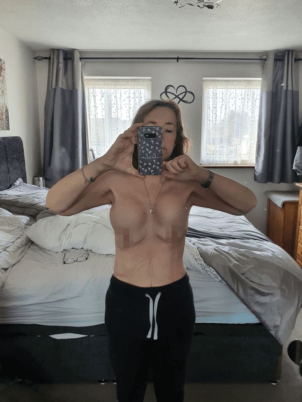英國一名婦人在土耳其浴到黑心診所,害她一度有4個胸部。(翻攝自《太陽報》)