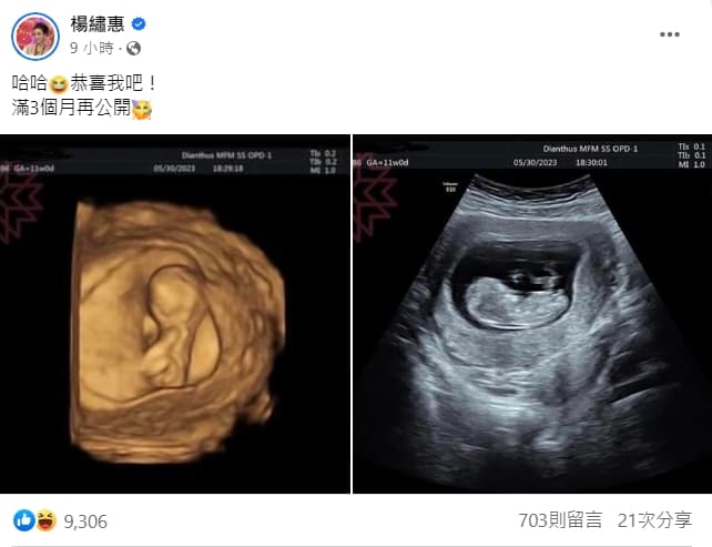 楊繡惠曬出兩張超音波照喊「恭喜我吧!」(翻攝自楊繡惠臉書)
