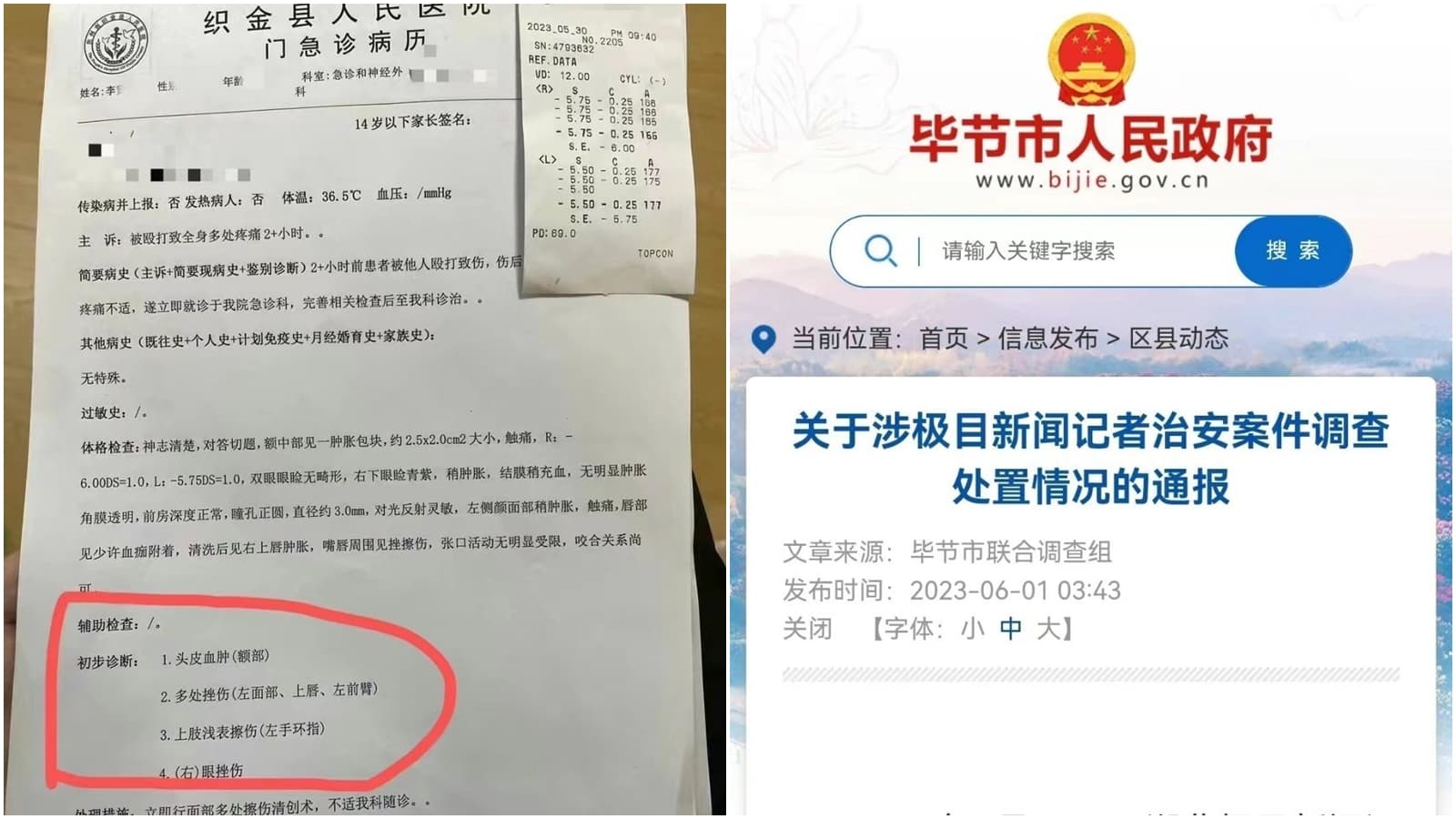 中國一名記者被警方圍毆後,引發相關機構關注。(翻攝自微博@新浪熱點)