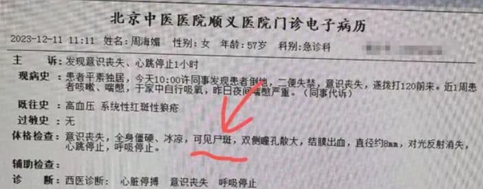周海媚急診病例在網路流傳。(翻攝自微博)