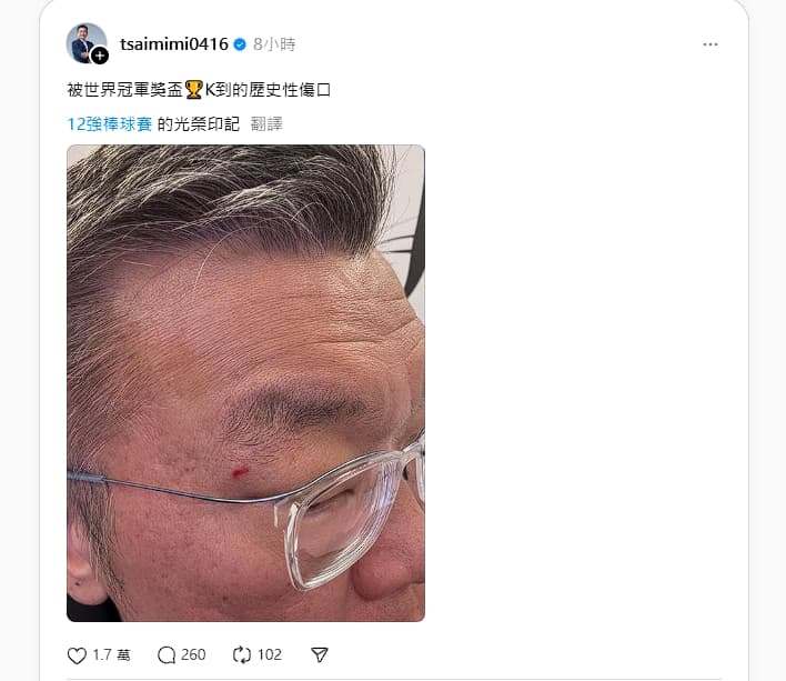 蔡其昌今分享被冠軍獎盃K到的「光榮印記」。(翻設自Threads)